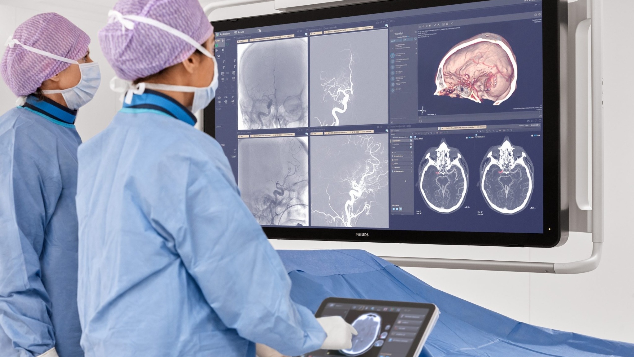 Azurion Image Guided Therapy System enables thrombectomy treatment ...
